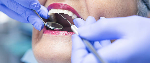 Best Broken or Cracked Tooth Emergency Dentist in St Peters, MO